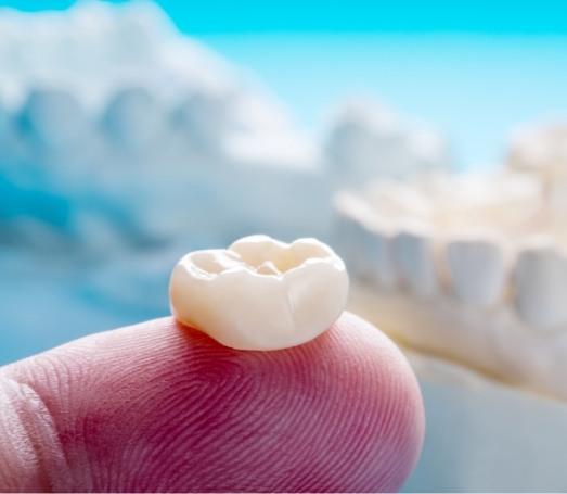 Close up of person holding a dental crown on their finger