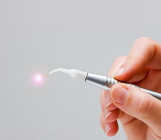 Hand holding a thin pen like soft tissue laser