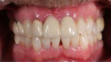 Close up of flawless smile after dental treatment