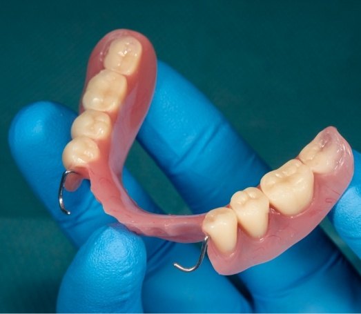 Gloved hand holding a partial denture