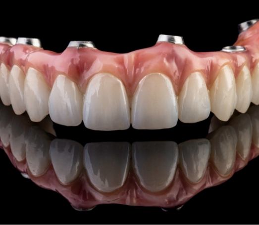 Upper implant denture against black background