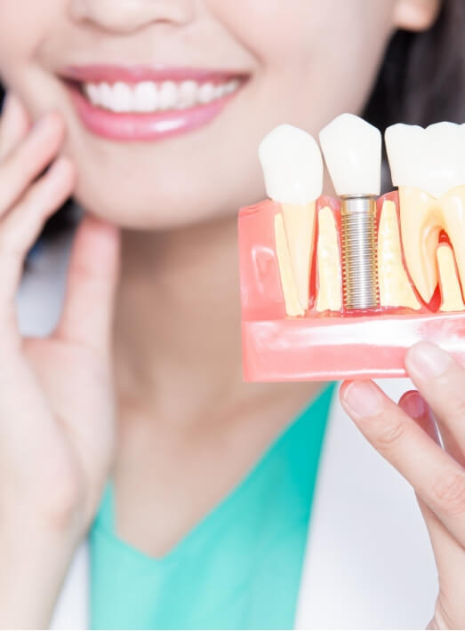 Dentist holding a model of dental implants in Los Angeles