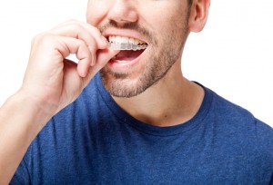 los angeles invisalign