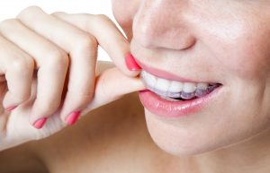 Did you know that you reduce risks of dental issues with Invisalign in West Los Angeles?