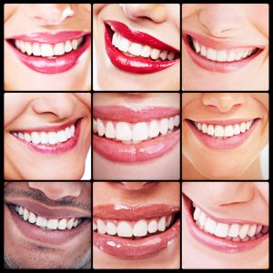 women smiling white teeth