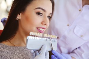 woman smiling posing with porcelain veneers