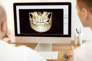 image of digital dental x-ray