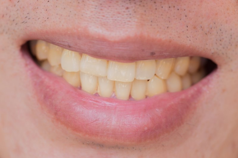 closeup of a yellow smile