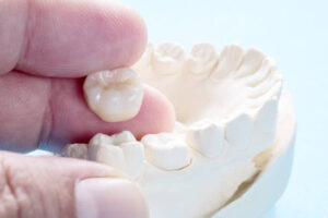 Dental crown held in fingertips near dental mold